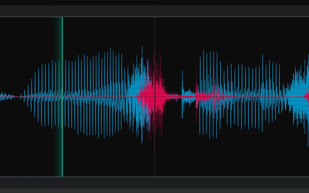 Sibilance detection